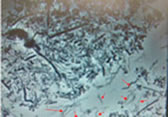 顕微鏡で見た病原菌2